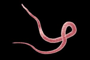 Harmful Effects of Parasites in Humans | Real Food RN