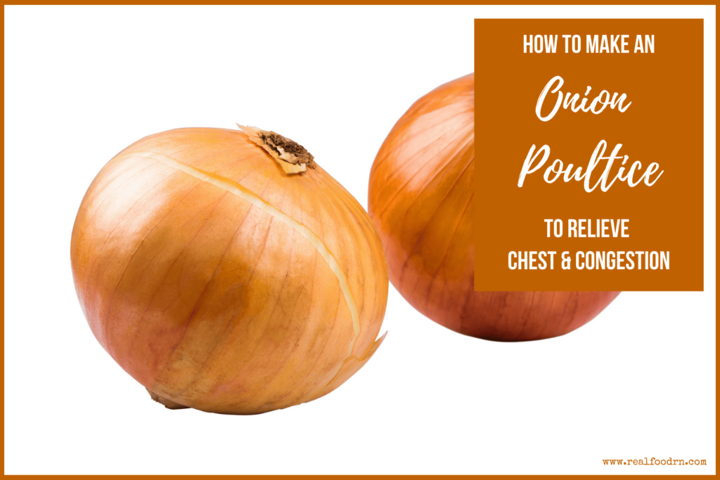 How to Make an Onion Poultice to Relieve Chest & Congestion | Real Food RN